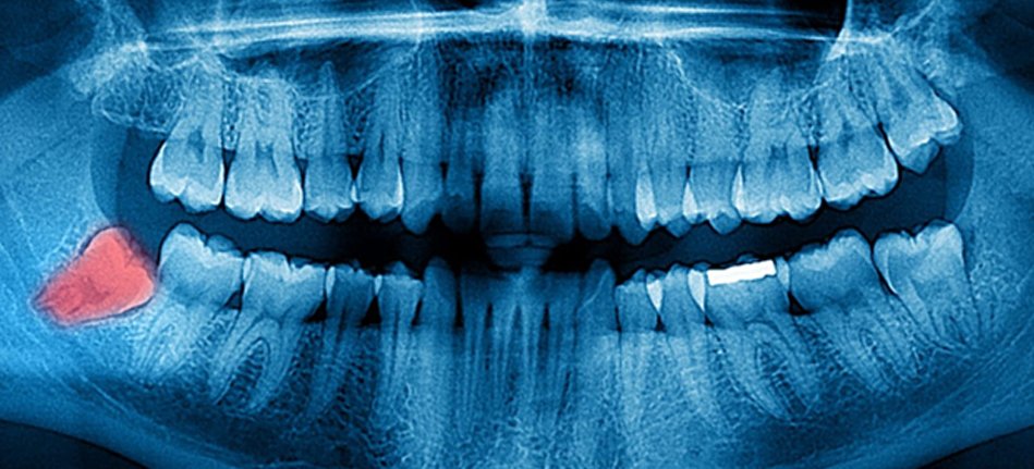 Best Oral Surgery in Faridabad