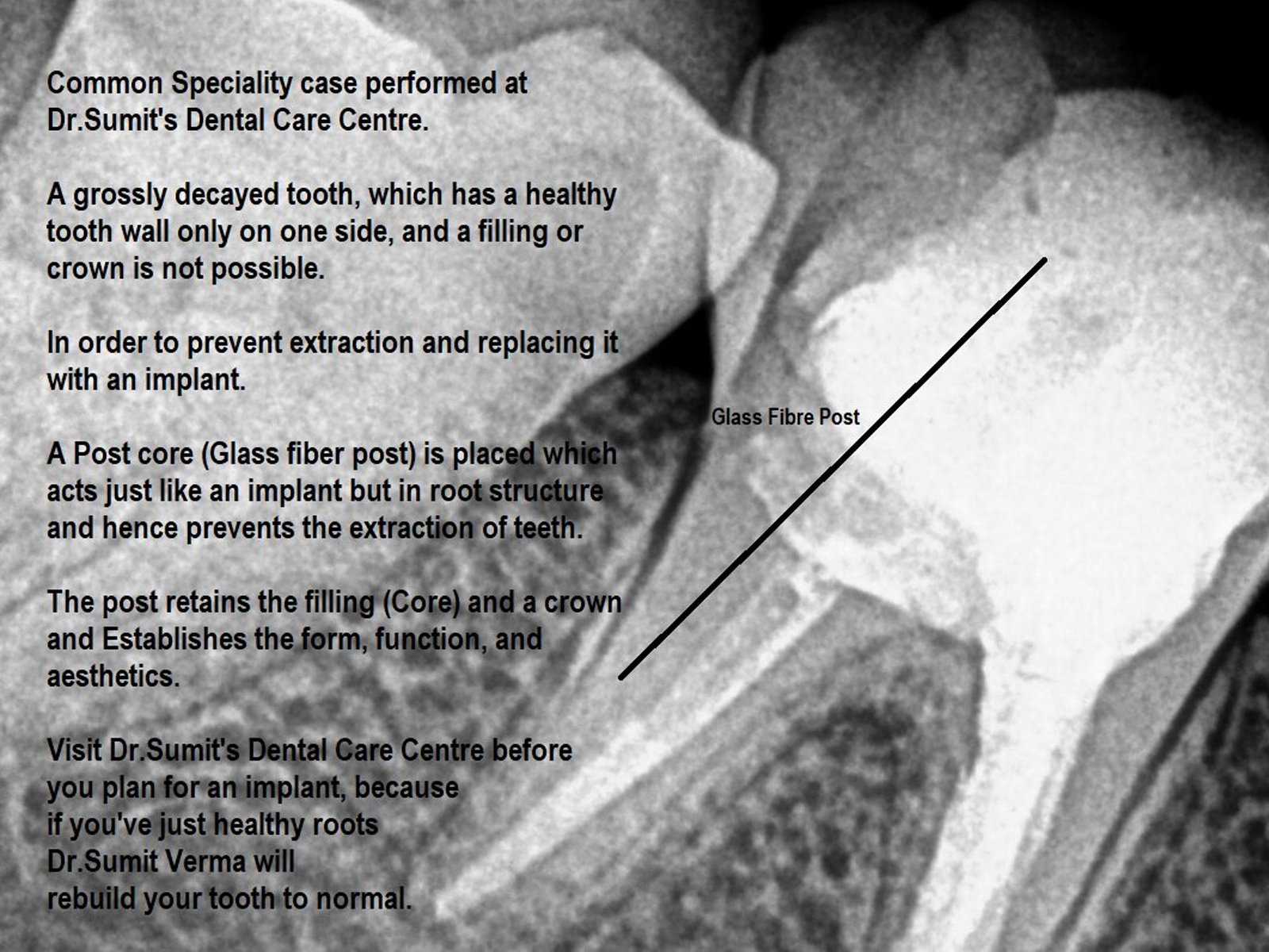 The Secrets To Clove Dentistry Dwarka sector 7